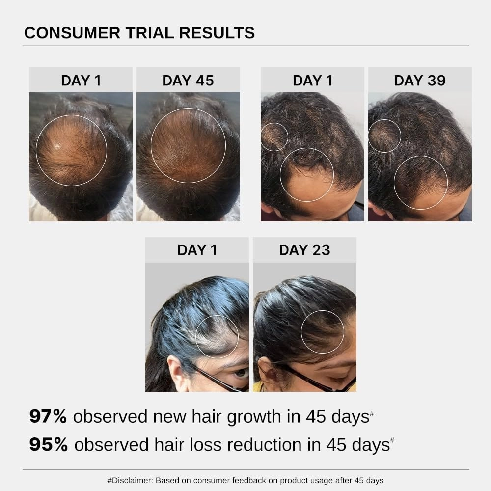 Bare Anatomy Advanced Hair Growth Serum with Rosemary, Rice extract, biotin - 30ml