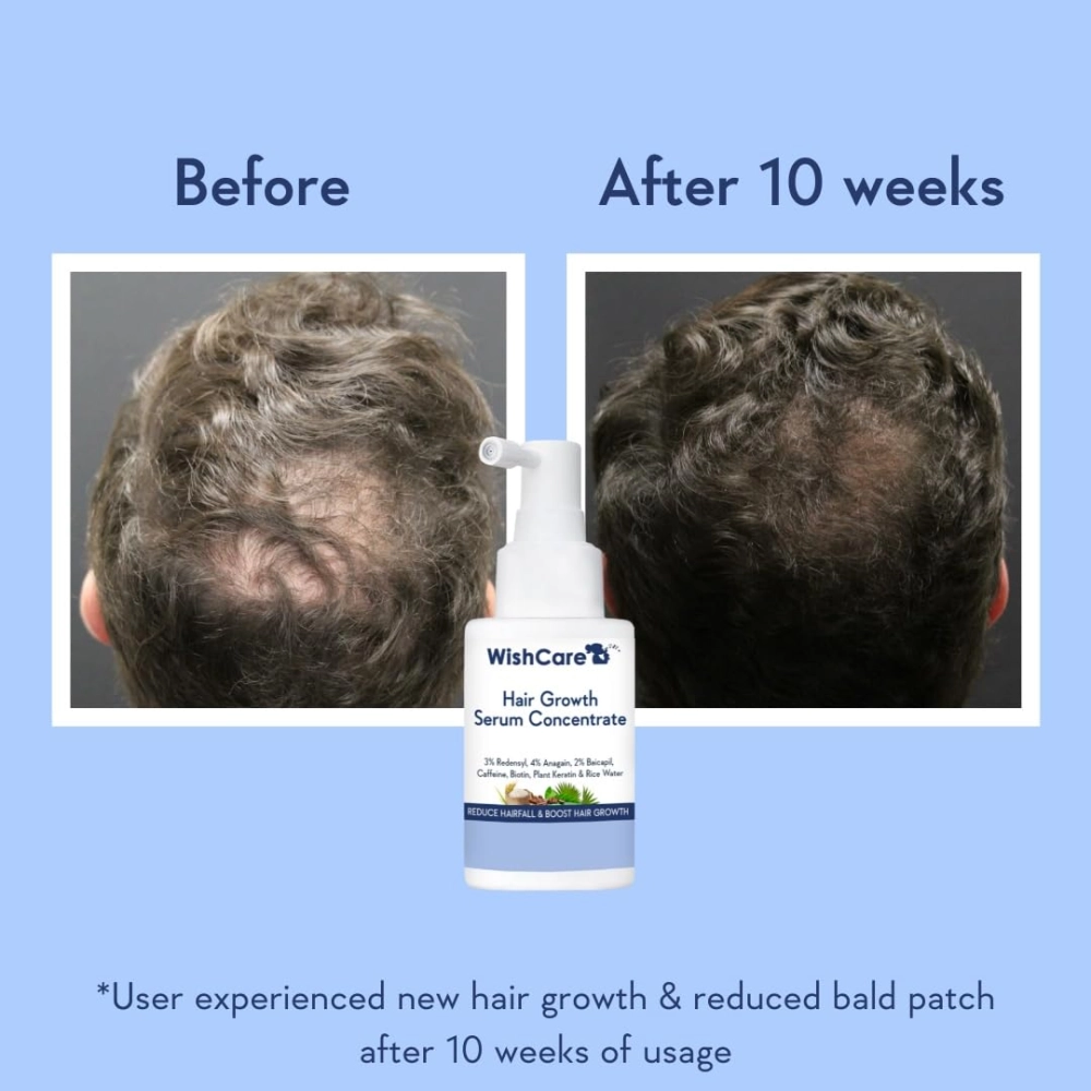WishCare Hair Growth Serum Concentrate 30ml